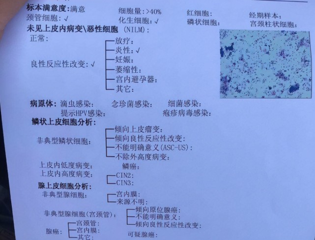 初步判断宫颈癌最简单的方法,看3处就知道,每个女人都应该学会