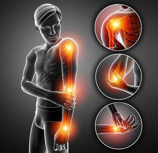 尤其是在运动的过程中肩部和左臂的疼痛感加剧时,就应该及时去医院做