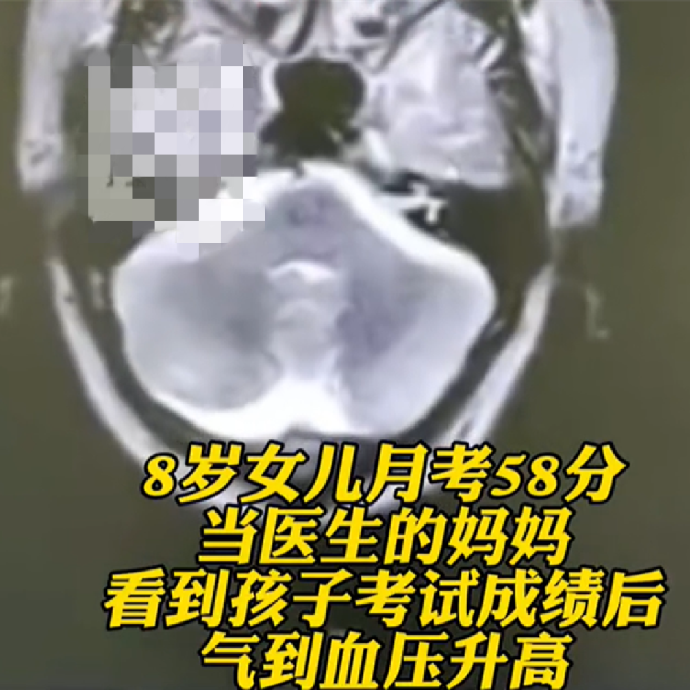 孩子是学渣家长气出脑梗接受孩子的平庸未来才会发光