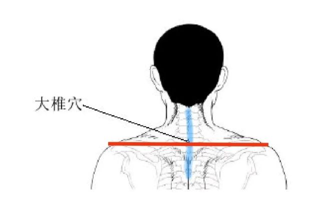 冬天冷,要保暖好大椎穴