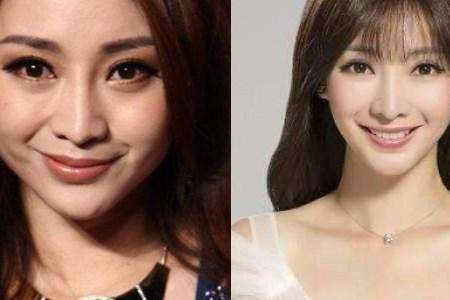 莫名其妙就歪嘴的女星金晨景甜都很严重这是动脸后遗症