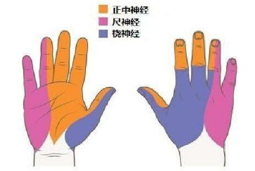 牵拉,摩擦等因素导致的神经病变,以尺神经支配区域的感觉障碍,骨间肌