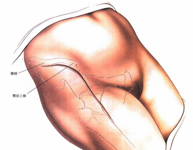 然后转向髌骨的外侧面,从髂前上棘垂直向远端延伸8~10cm(见图8-4)