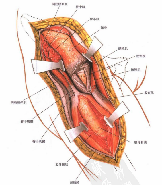 【骨科小技巧】髋关节前侧入路!