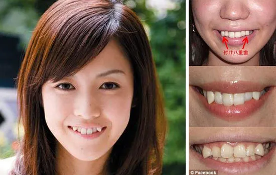 日本女人的牙齿普遍都不整齐没想到原来是她们故意整成这样的