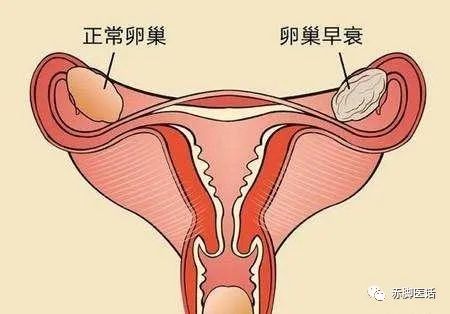 卵巢好的女性一般有4个特征若有一个也不错对照自查一下