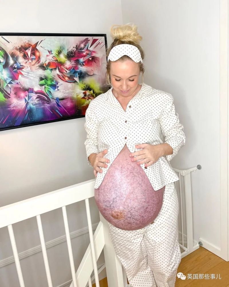 丹麦妈妈晒三胞胎孕肚横向生长布满血丝几乎悬浮身体之外