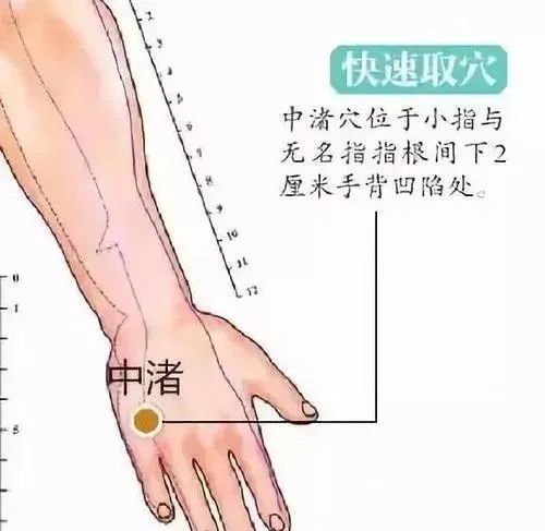 急性腰痛有几种"一针疗法"