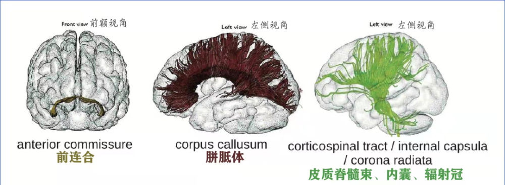 精美解剖图白质纤维束