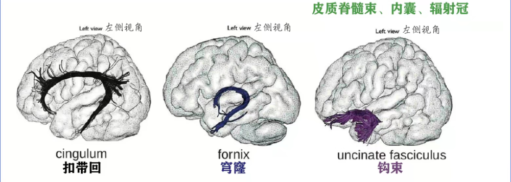 精美解剖图白质纤维束