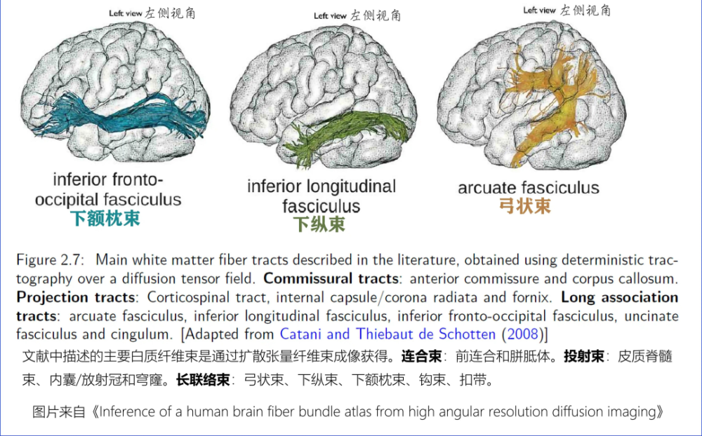 精美解剖图白质纤维束