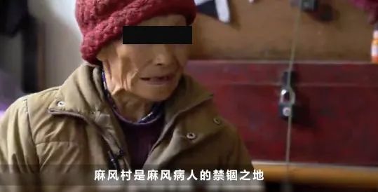 治愈后仍不被接纳,这种病成了他们一生的枷锁|麻风病|中国麻风防治