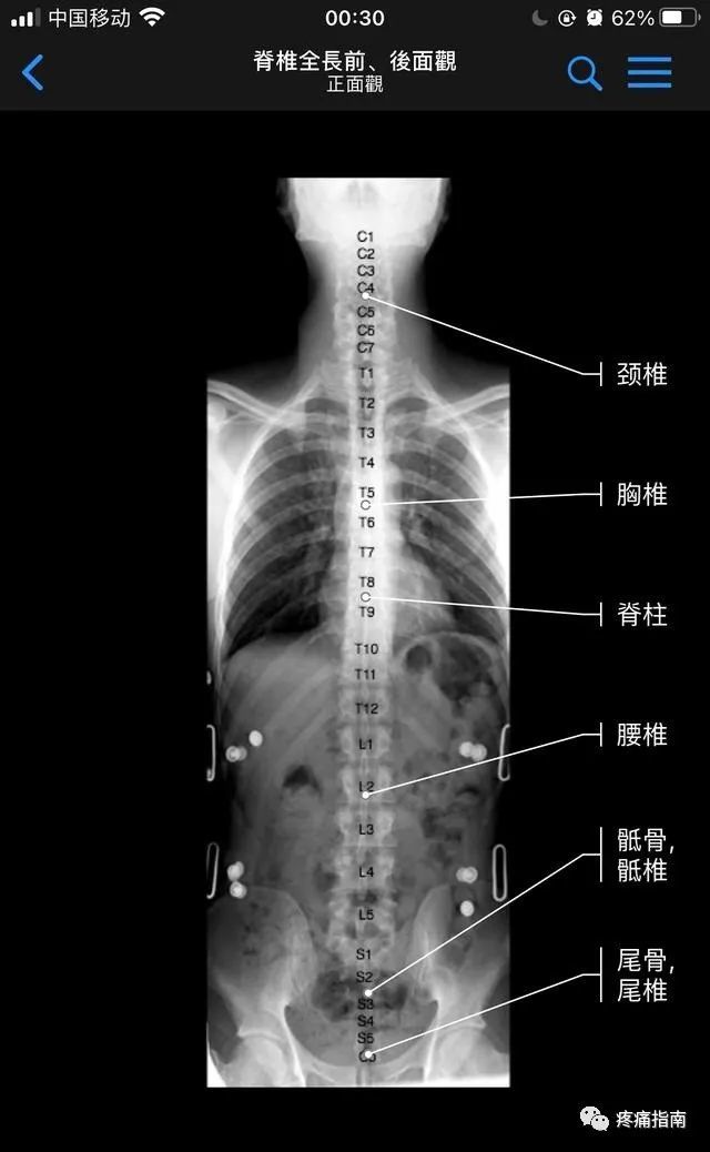 脊柱dr影像基础|脊柱|横突|颈椎
