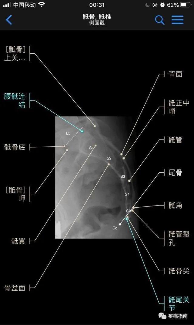 3,棘突,4,横突(本例4,5钩椎关 节不对称)下位颈椎与上位胸椎x光片(1