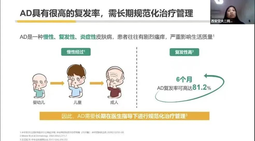 特应性皮炎(ad)的治疗和管理是一个长期的过程需要专业医生综合评估
