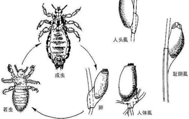 这是真的!与人类共存,活上千万年了,为何虱子现今很难见到了?