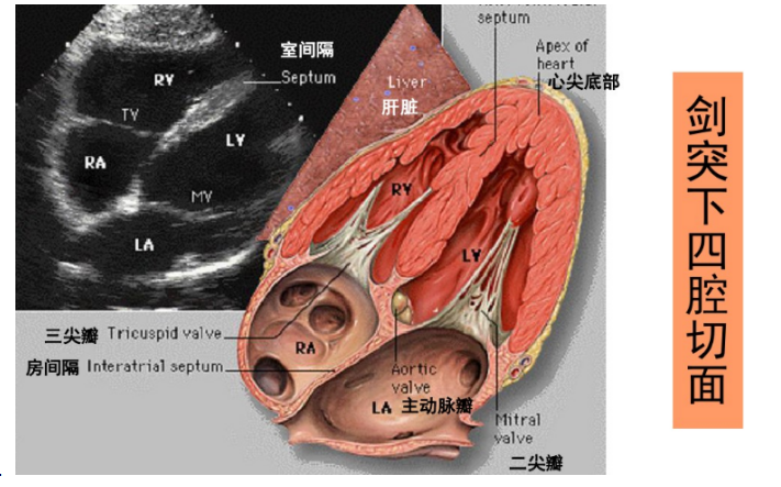 太直观了心超各种切面各种图