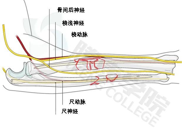 与桡神经的其他分支不同,骨间后神经没有感觉受体,只负责肌肉运动.