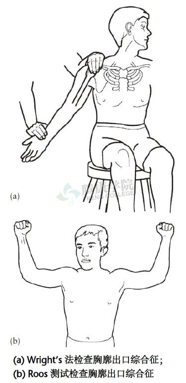 roos试验患者保持站立位,外展和外旋双臂,肘关节屈曲90,患者重复松