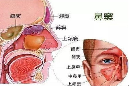 将鼻窦炎中的分泌物引出体外,使病肺处于高位,其引流支气管的开口向下