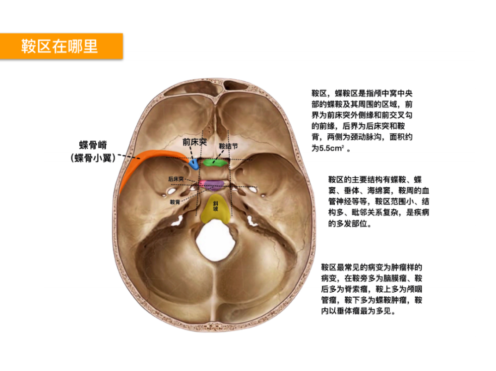 此篇主要讲解鞍区的重要性,鞍区的精细解剖,鼻腔骨性结构,蝶鞍-垂体窝