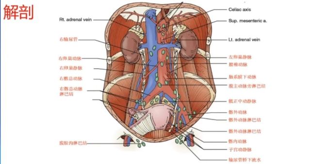 王小元教授:腹主动脉旁淋巴结切除术的相关解剖