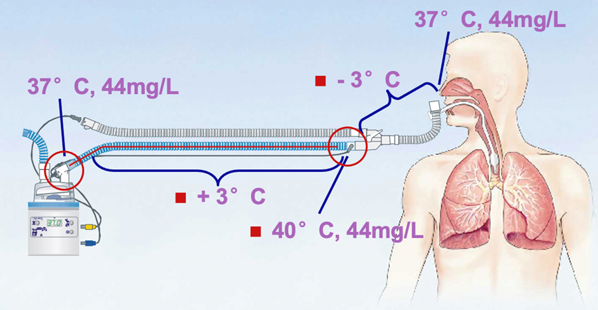 诸多温湿化不当的情况增加了上气道细菌移位及院内感染风险气管插管