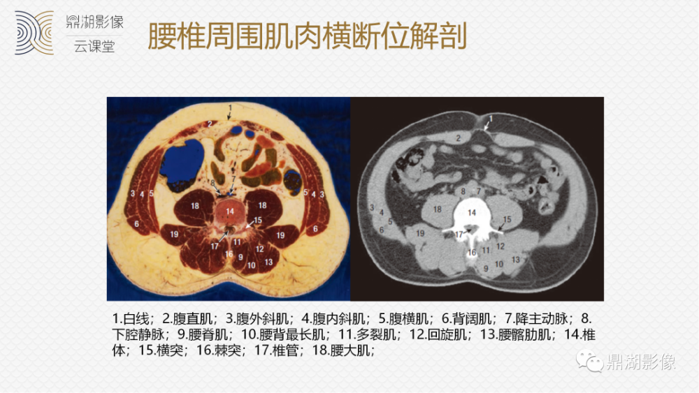 第三部分:脊柱韧带(16p)视频讲解第二部分:椎间盘完整内容(16p.