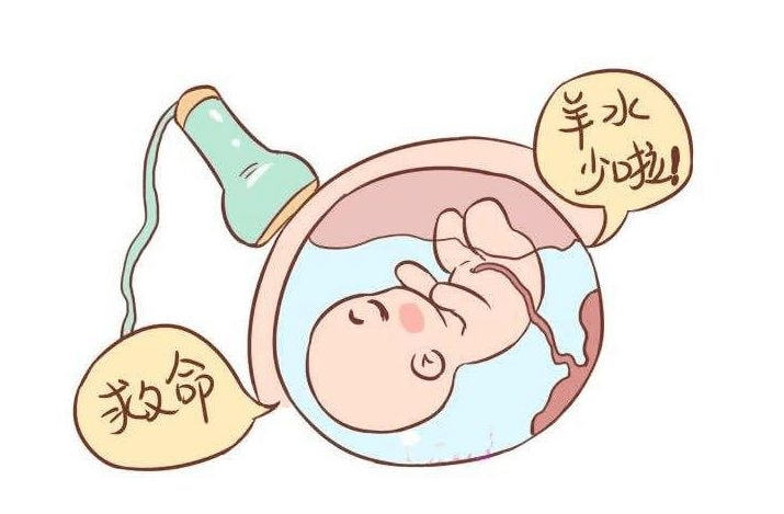 对羊水指数云里雾里羊水量多或少要这样看