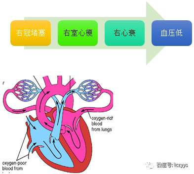 心血管系统第六单元冠心病考试讲义