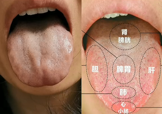 中医从舌头看健康四个舌诊案例每日舌诊分析
