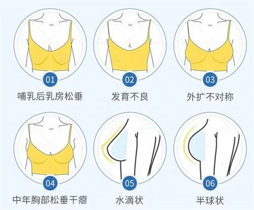 中韩隆胸名医大比拼,北京联合丽格杨大平vs韩国必当归柳济圣