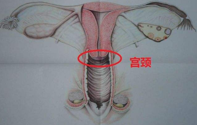 子宫内膜息肉和宫颈息肉,哪个更严重,要做手术吗?