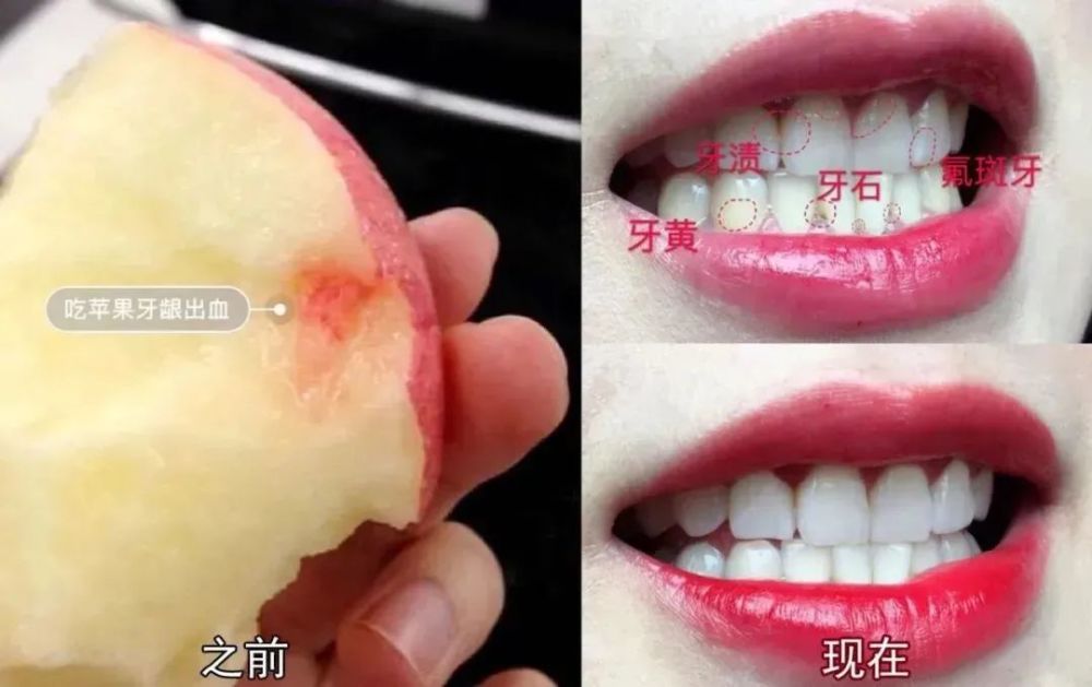 这个牙膏界的爱马仕迅速溶解牙垢口气清新一整天