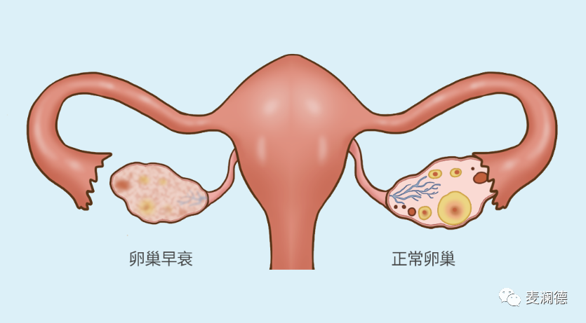 卵巢养不好女人老的快关于卵巢的四个知识点