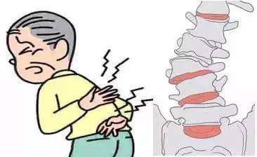 老年人经常腰背痛当心退行性脊柱侧弯在作怪ads病例分享