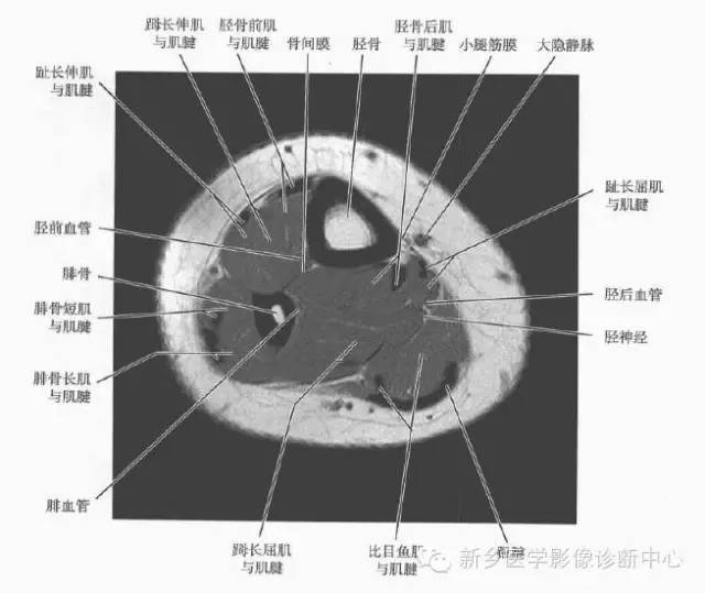 小腿部断层解剖详细标注