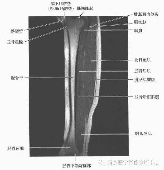 小腿部断层解剖详细标注