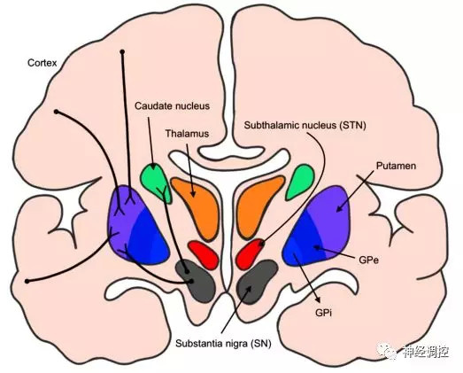 dbs基础与未来趋势|dbs|原发性肌张力障碍|纹状体神经元|苍白球