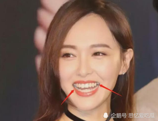 整牙后遗症最严重的就是色差问题,整了大牙后的唐嫣,牙齿色差很明显