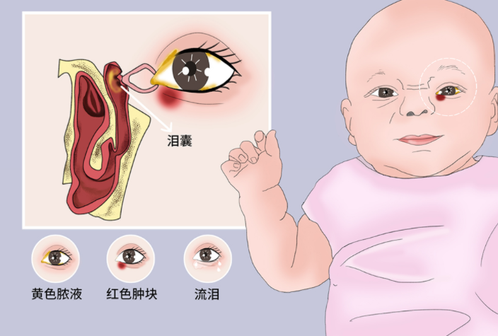 医生眼睛里修路让脏孩子终于变干净了