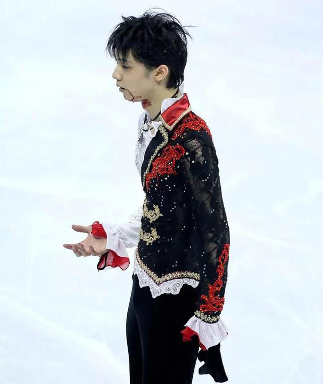 日本花滑选手羽生结弦今日再上冰,四年前成功卫冕冬奥会冠军