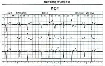 精彩病例丨cdqi实践出真知第三十七期青少年致心律失常性右室心肌病1