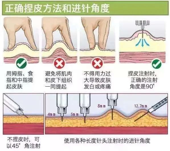 胰岛素注射导致皮下脂肪增生的危险因素1,不规范轮换或未更换注射部位