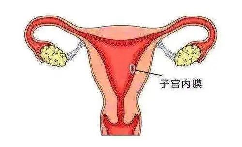 每个月正常来大姨妈吗?子宫内膜损伤千万不能忽视!