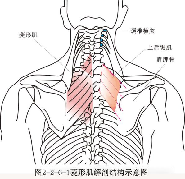 肩部埋线针刀操作技巧以及菱形肌牵拉手法应用