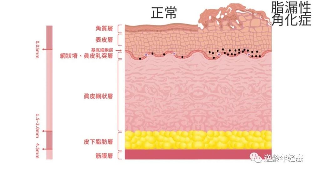 科普14种不同的色斑你能分得清吗