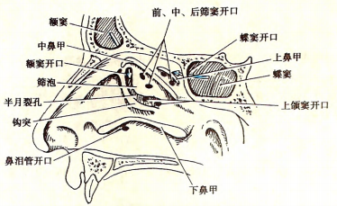 鼻窦开口(上,中,下鼻甲及筛骨迷路内侧壁切除)鼻窦的气化上颌窦在4岁