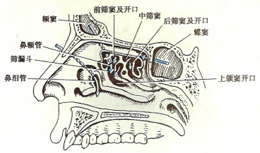 鼻窦开口(上,中,下鼻甲及筛骨迷路内侧壁切除)鼻窦的气化上颌窦在4岁