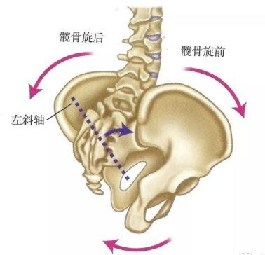 髂前上棘低(2)髂后上棘:右侧髂后上棘比左侧髂后上棘高(3)骨盆上缘